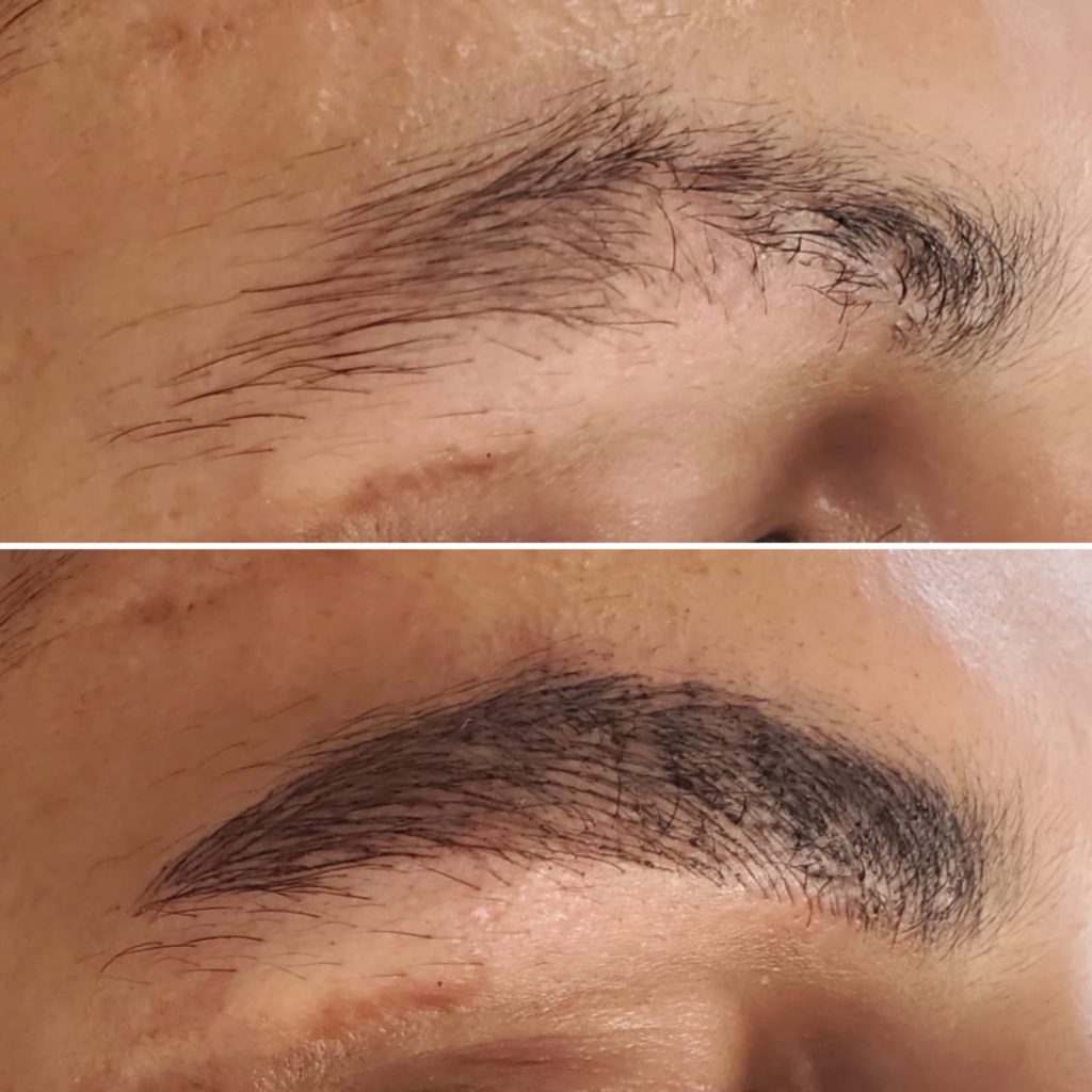 Microblading Eyebrows | Dérmica MedEsthetics, Edmonton, AB.