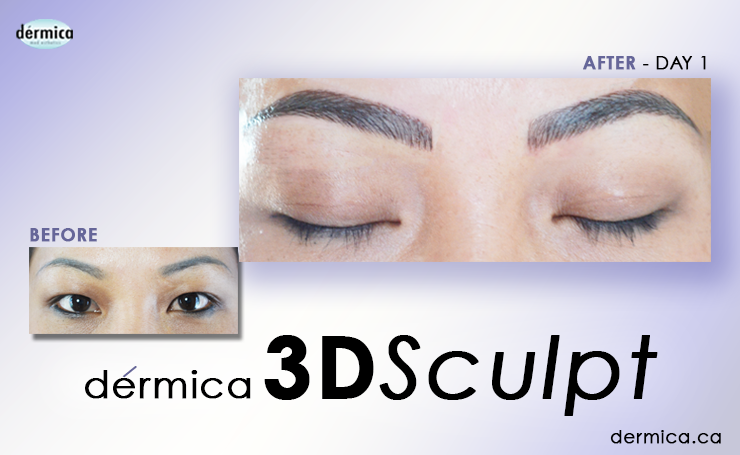 Eyebrow Embroidery Edmonton- Pre-Treatment Guide » Dérmica ...