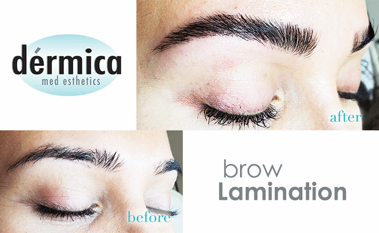 Brow Lamination vs. Microblading » Dérmica MedEsthetics