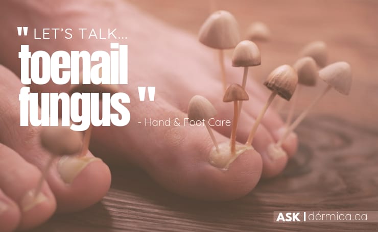 Pedicure for Nail Fungus: The Anti-Fungal